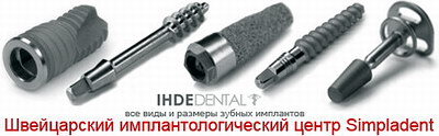 Зубные имплантаты Ihde Dental - ИМПЛАНТАЦИЯ ЗУБОВ в МОСКВЕ – центр зубной имплантации СИМПЛАДЕНТ